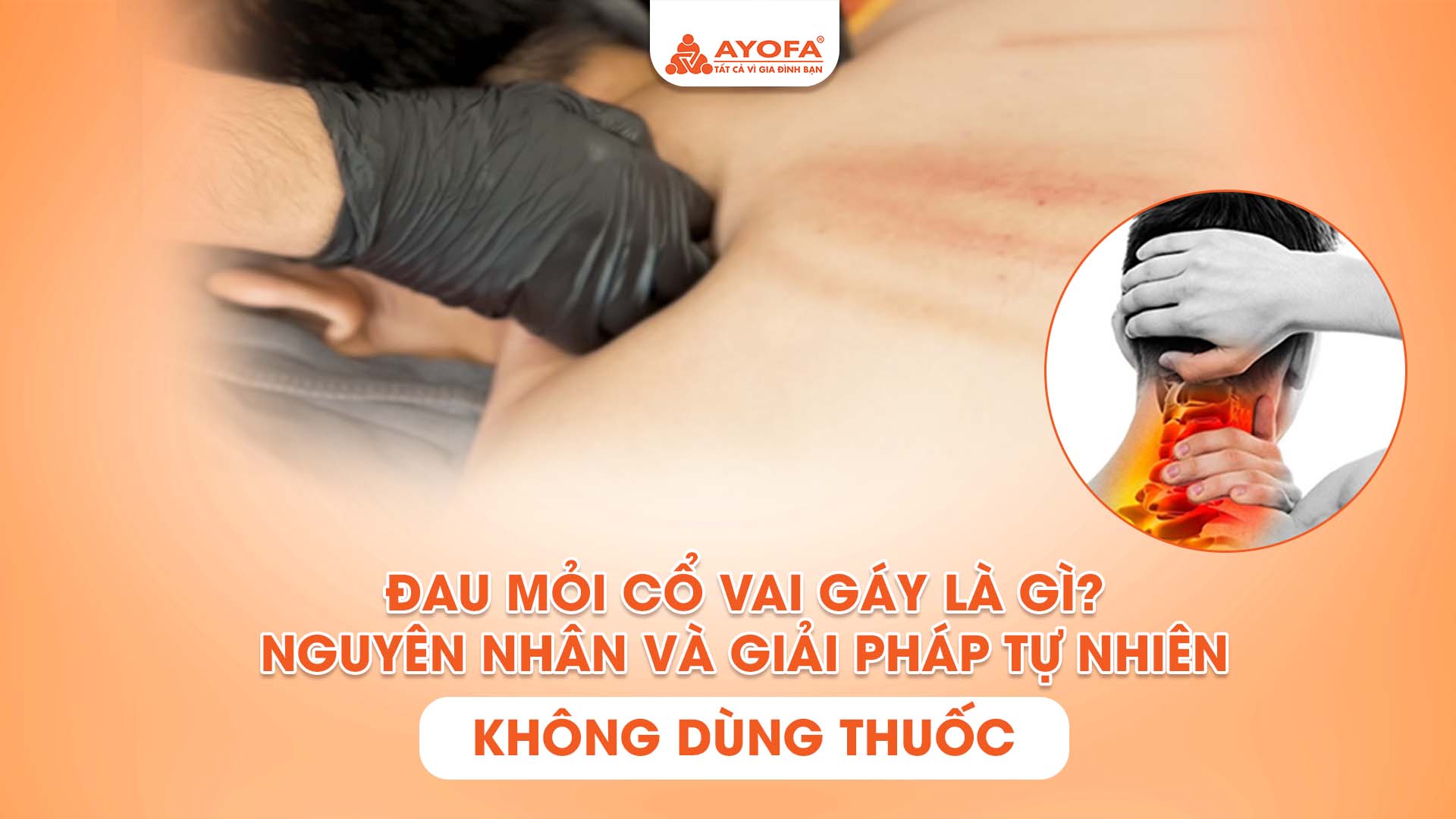 ĐAU MỎI CỔ VAI GÁY LÀ GÌ? NGUYÊN NHÂN VÀ GIẢI PHÁP TỰ NHIÊN KHÔNG DÙNG THUỐC