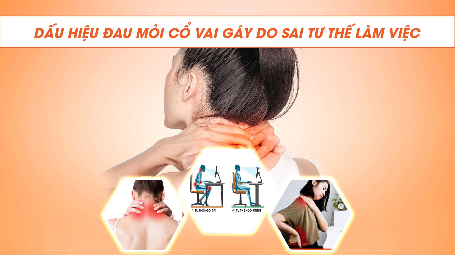 DẤU HIỆU ĐAU MỎI CỔ VAI GÁY DO SAI TƯ THẾ LÀM VIỆC